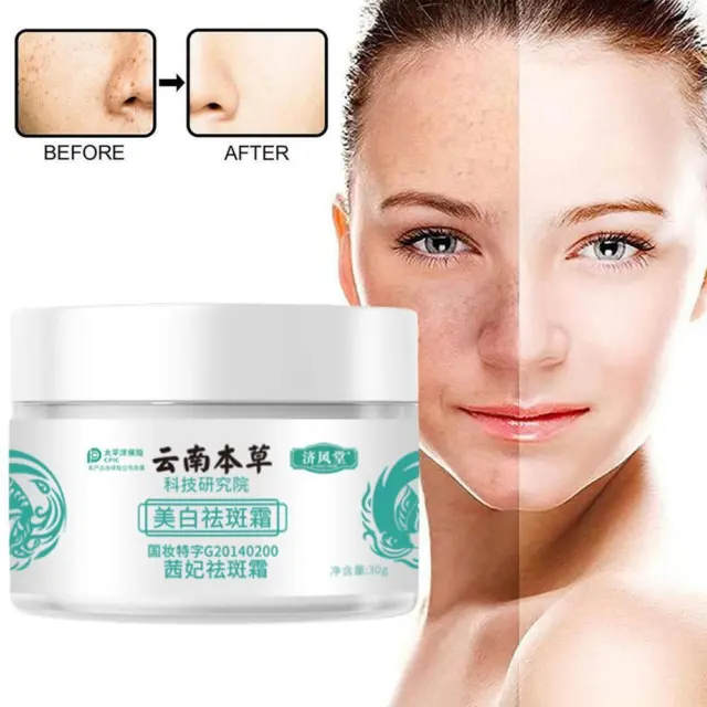 Japanese-Melasma-Cream-Hoshi-Cream-JapanDr-Hancy-Face.webp